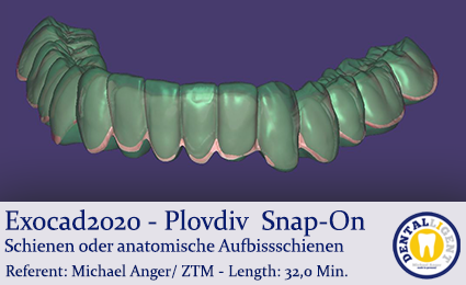 Product image of the product “2020-Exocad - Exocad Plovdiv -Snap-On-Schienen oder anatomische Aufbissschienen ”