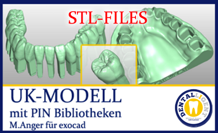 Product image of the product “STL-FILES +  LIBRARY  - Upper jaw-MODELL with PIN- LIBRARY  for exocad by M. Anger ”