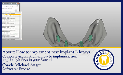 Product image of the product “Topic: How to implement new implant Librarys ”