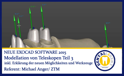 Product image of the product “2015-Modellation von Teleskopen Teil 3 - Exocad 2015 ”
