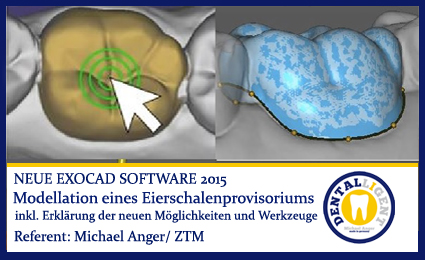 Product image of the product “2015-Modellation eines Eierschalenprovisoriums ”