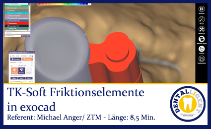 Product image of the product “Exocad-2019 EXOPLAN 1 - Teil 2 ”