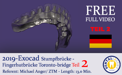 Product image of the product “2019 - EXOCAD - TORONTO-BRIDGE - Fingerhutbrücke TEIL 2 ”