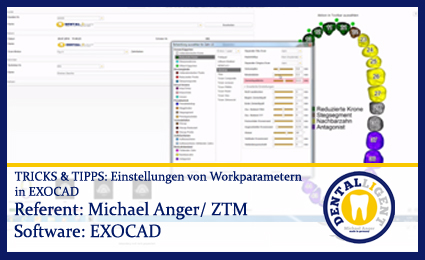Product image of the product “TIPPS & TRICKS - Einstellungen in den Workparametern von EXOCAD ”
