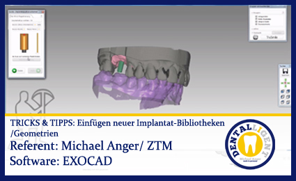 Product image of the product “TIPPS & TRICKS - Einfügen von neuen Implantat-Bibliotheken / -Geometrien ”