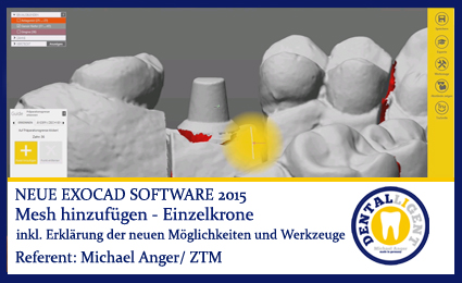 Product image of the product “Mesh hinzufügen am Beispiel einer Einzelkrone - Exocad 2015 ”
