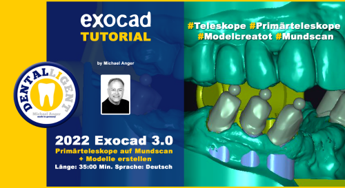 Product image of the product “2022-Exocad 3.0 – Primärteleskope auf Mundscan ”