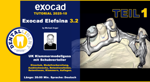 Product image of the product “Exocad Elefsina 3.2 - 2025-10 - UK Klammermodellguss mit Schubverteiler TEIL 1 ”