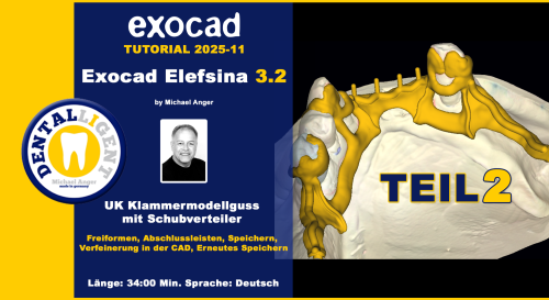 Product image of the product “Exocad Elefsina 3.2 - 2025-11 - Klammermodellguss mit Schubverteiler TEIL 2 ”