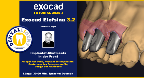 Product image of the product “Exocad Elefsina 3.2 - 2025-2 - Teleskope + skelettierter Modellguss im Stegdesign TEIL 2 ”