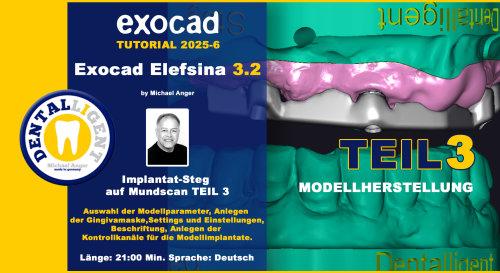 Product image of the product “Exocad Elefsina 3.2 - 2025-5 -Implantat Steg auf Mundscan Teil 2 ”