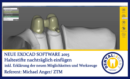 Product image of the product “2015-Haltestifte nachträglich einfügen - Exocad 2015 ”