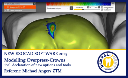 Product image of the product “Modelling Overpress-Crowns ”