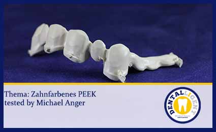 Product image of the product “GRATIS - Innovation - Zahnfarbenes PEEK ”