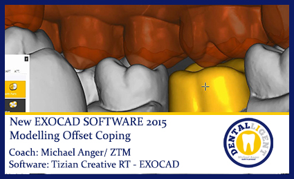 Product image 1 of the product “Modelling Offset Coping ”