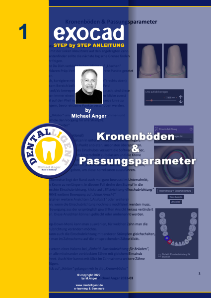 Product image 1 of the product “Exocad Step by Step Anleitung - Nr. 1 - Kronenböden & Passungsparameter ”