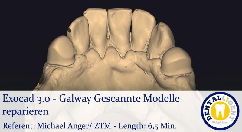 Product image 1 of the product “2021-Exocad 3.0 –  Galway Gescannte Modelle reparieren ”