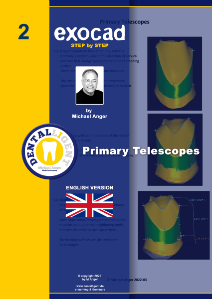 Product image 1 of the product “Exocad Step by Step - Nr.2 -Primary Telescopes ”