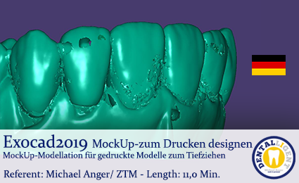 Artikelbild 1 des Artikels “2020-Exocad - MockUp-zum Drucken designen “