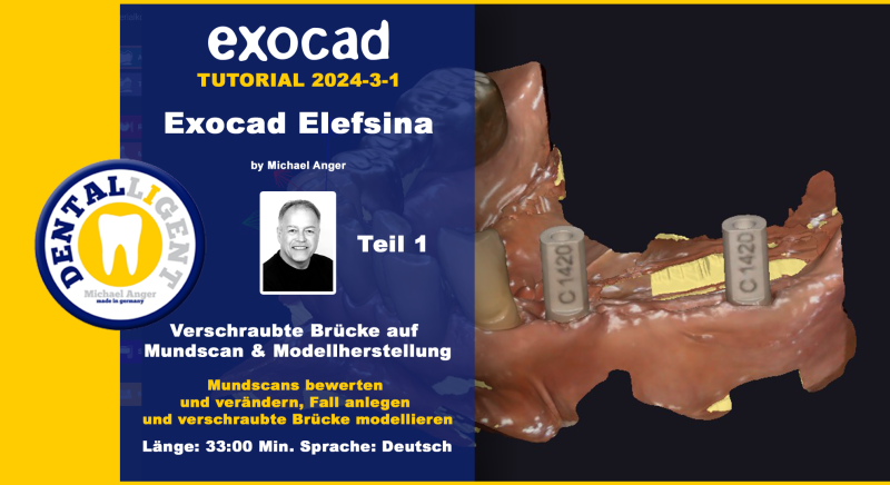 Product image 1 of the product “Exocad Elefsina 2024-3 Teil 1 Verschraubte Brücke auf Mundscan & Modellherstellung ”