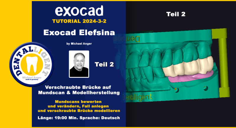 Product image 1 of the product “Exocad Elefsina 2024-3 Teil 2 Verschraubte Brücke auf Mundscan & Modellherstellung ”