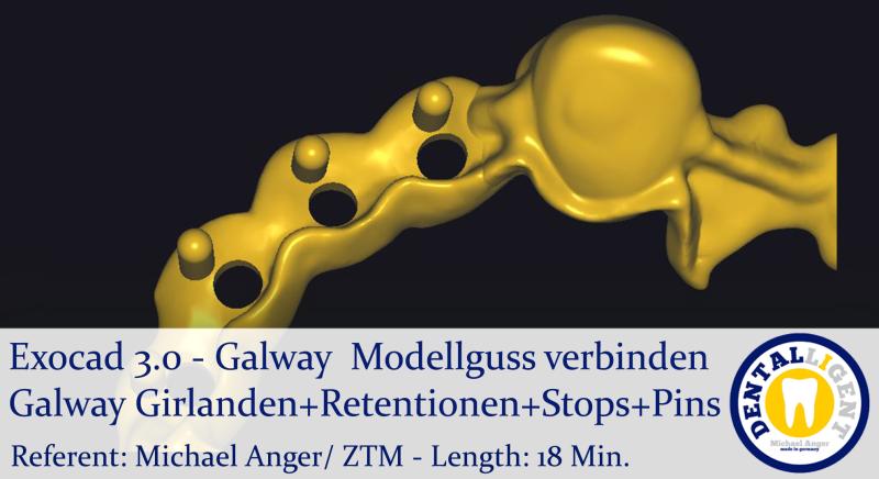 Product image 1 of the product “2021-Exocad 3.0 – Galway  Modellguss verbinden Galway ”