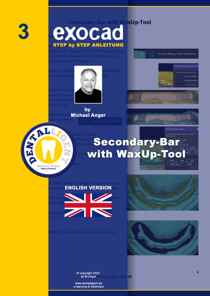 Product image 1 of the product “Exocad Step by Step Anleitung - Nr. 3 - Secondary Bar with Wax-up Tool ”