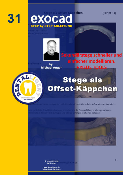Artikelbild 1 des Artikels “Exocad Step by Step Anleitung -Nr. 31 - Stege als Offset-Käppchen “