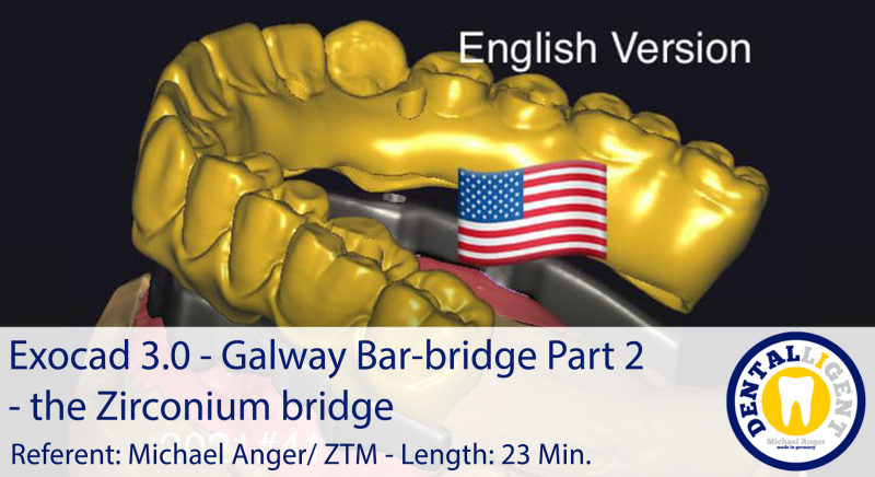 Product image 1 of the product “2021-Exocad 3.0 – Galway Bar-bridge Part 2 - the Zirconium bridge ”