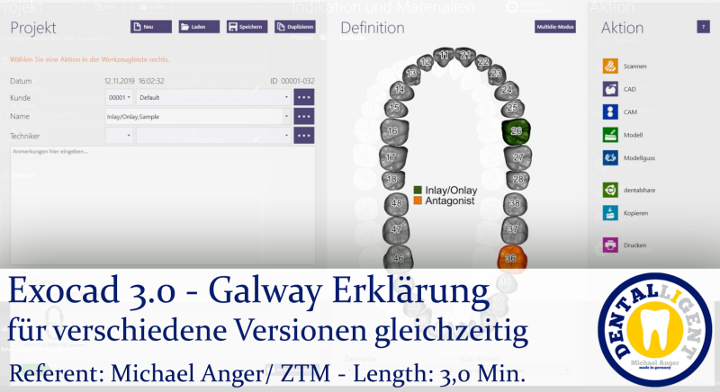 Artikelbild 1 des Artikels “2021-Exocad - Exocad 3.0 - Galway Erklärung für verschiedene Versionen gleichzeitig “