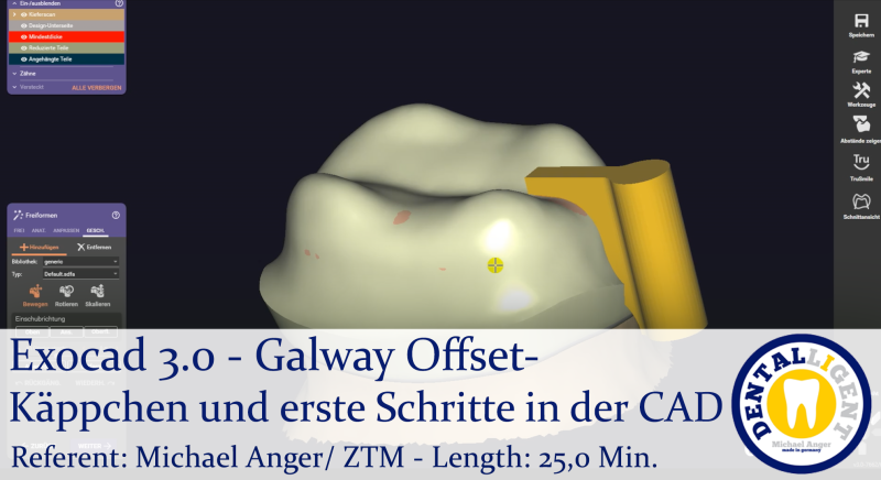 Product image 1 of the product “2021-Exocad 3.0 – Galway Offset-Käppchen und erste Schritte in der CAD ”
