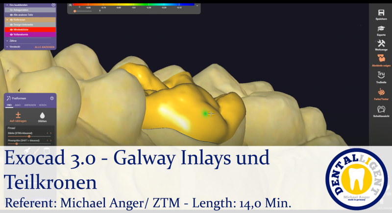 Product image 1 of the product “2021-Exocad 3.0 – Galway Offset-Käppchen und erste Schritte in der CAD ”