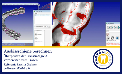 Product image 1 of the product “iCAM 4.6 Aufbissschiene berechnen ”