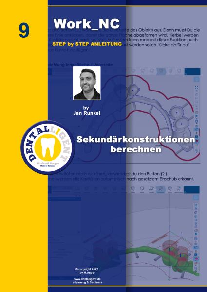 Product image 1 of the product “Exocad Step by Step Anleitung - Nr. 9 - Sekundärkonstruktionen berechnen ”