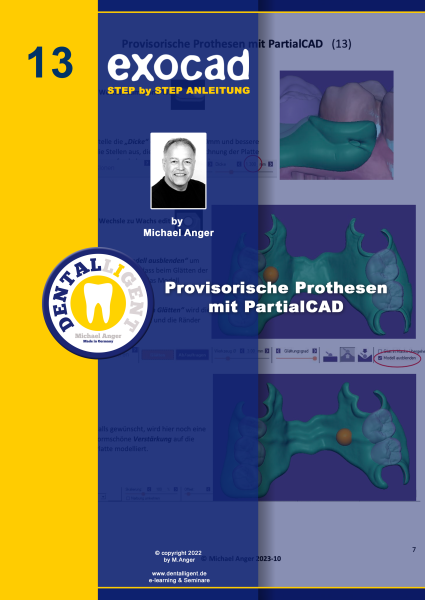 Product image 1 of the product “Exocad Step by Step Anleitung - Nr. 13 - Provisorische Prothesen  mit PartialCAD ”