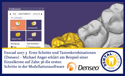Product image 1 of the product “2017-NEW EXOCAD TUTORIAL DENSEO 2017-3 - Erste Schritte und Tastenkombinationen ”