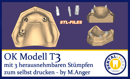 Artikelbild 1 des Artikels “OK-Modell T3-STL-Daten zum selbst drucken “