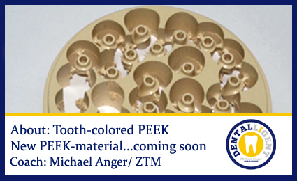 Artikelbild 1 des Artikels “Free full video - About: New tooth-coulored PEEK - New PEEK-material coming soon “