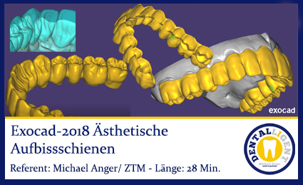 Artikelbild 1 des Artikels “2018-Exocad- Ästhetische Aufbissschienen “
