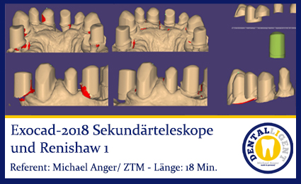 Product image 1 of the product “2018-Exocad-Sekundärteleskope und Renishaw 1 ”