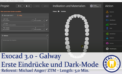 Product image 1 of the product “2021-Exocad 3.0 -Galway Erste Eindrücke und Dark-Mode ”