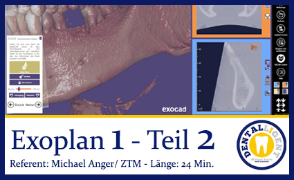 Product image 1 of the product “2019-Exocad  EXOPLAN 1 - Teil 2 ”