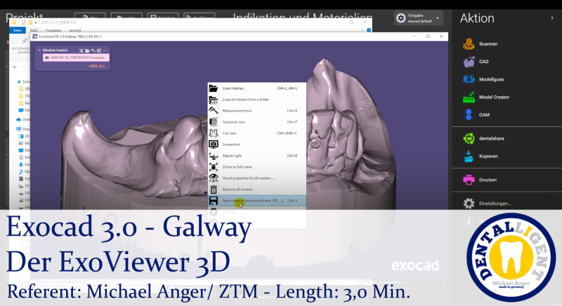 Product image 1 of the product “2021-Exocad 3.0 -Galway Exoviewer 3D ”