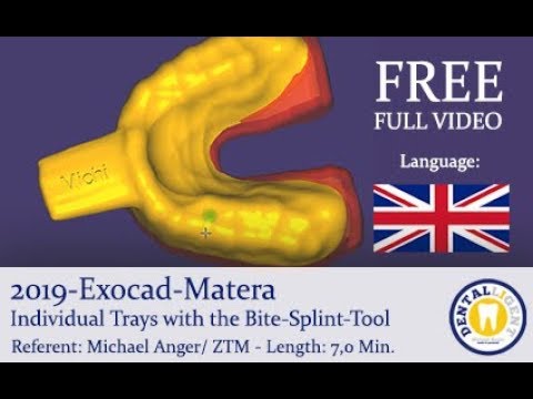 Artikelbild 1 des Artikels “2019 - FREE FULL EXOCAD TUTORIAL - Exocad-Matera Individual Trays with the Bite-Splint-Tool “