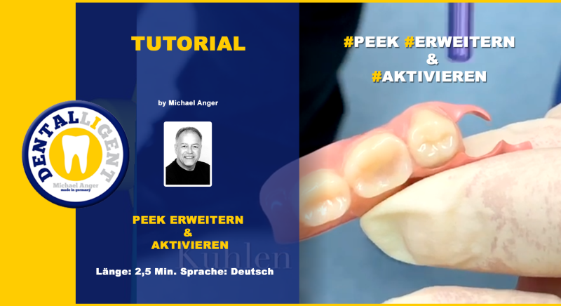 Artikelbild 1 des Artikels “GRATIS - Thema: PEEK ERWEITERN & AKTIVIEREN “