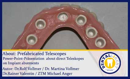 Artikelbild 1 des Artikels “GRATIS - Prefabricated Telescopes “