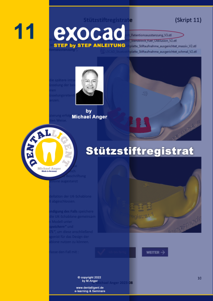 Product image 1 of the product “Exocad Step by Step Anleitung - Nr. 11 - Stützstiftregistrat ”