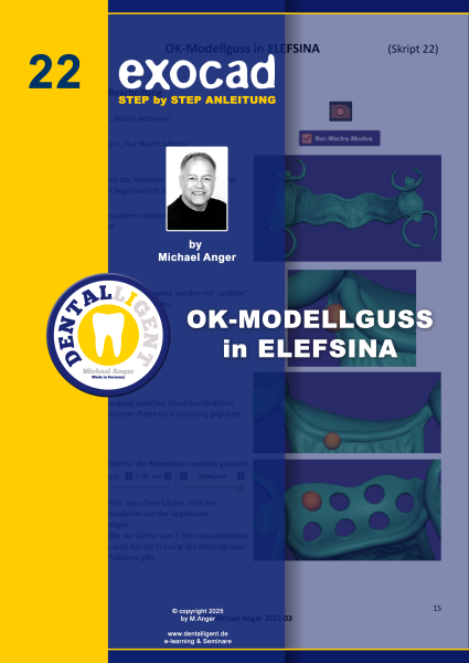 Product image 1 of the product “Exocad Step by Step Anleitung - Nr. 22 OK-Modellguss in ELEFSINA ”