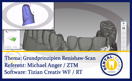 Product image 1 of the product “Grundprinzipien von einem Renishaw-Scan ”