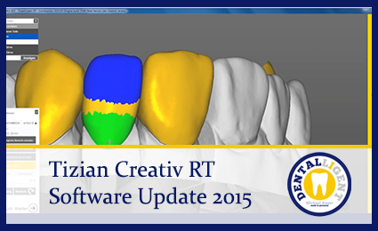 Artikelbild 1 des Artikels “GRATIS Video - Schütz Tizian Creativ RT Software Update “